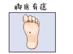 脚底有黑眼代表什么算命？脚底有痣人真的会发达吗？