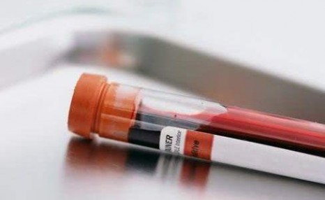AB型血为什么叫贵族血？4个血型哪个血型最好