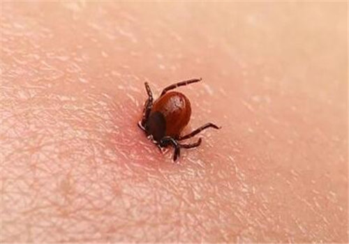 蜱虫咬人后有什么症状？它的天敌是谁？怎么快速消灭？