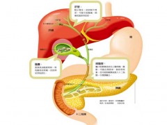 胆结石有哪些表现症状?