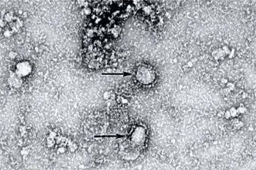 新型冠状病毒属于哪类传染病？是由什么引起的？