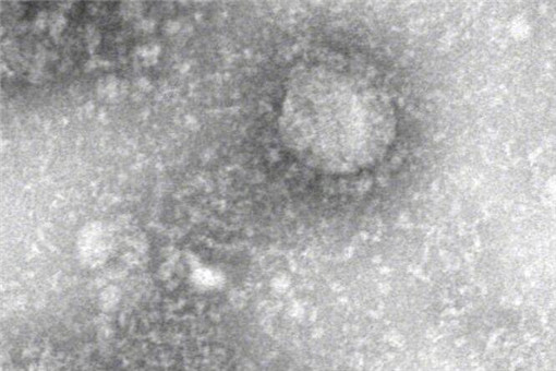 新型冠状病毒属于哪类传染病？是由什么引起的？
