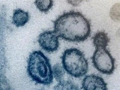 新冠病毒常态化流行可能性不大！什么情况？会变成慢性病的问题？