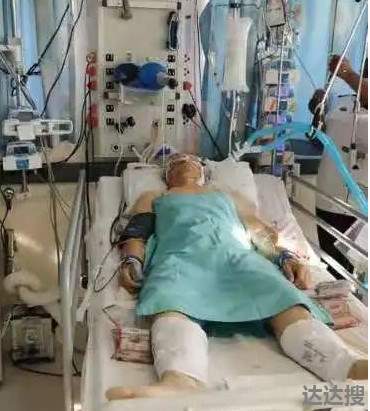 南非夸祖鲁省一华人遭抢劫中枪,生命垂危1