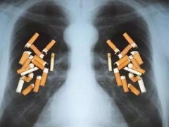 中国50%的肺癌因吸烟引起！中国每年吸烟得肺癌的有多少人？