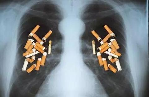 中国50%的肺癌因吸烟引起