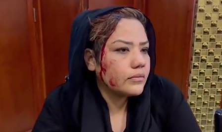 阿富汗塔利班阻止喀布尔女性示威